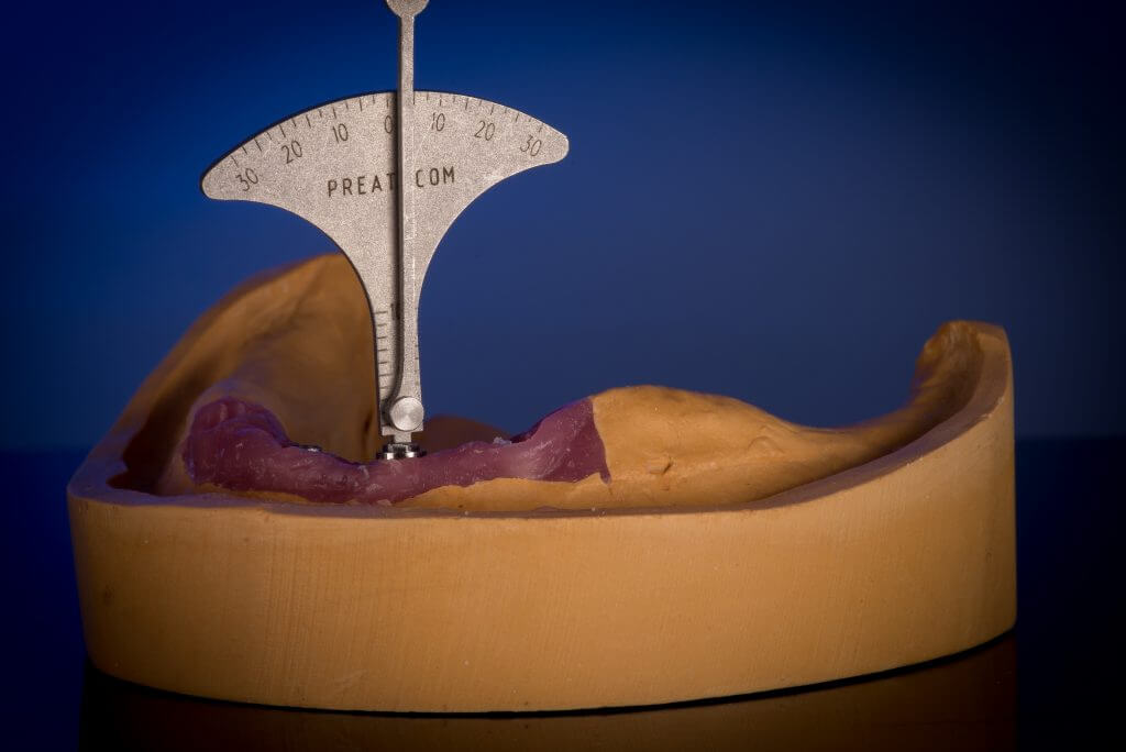 Cuff Height and Angulation Tool Set Prestige Dental