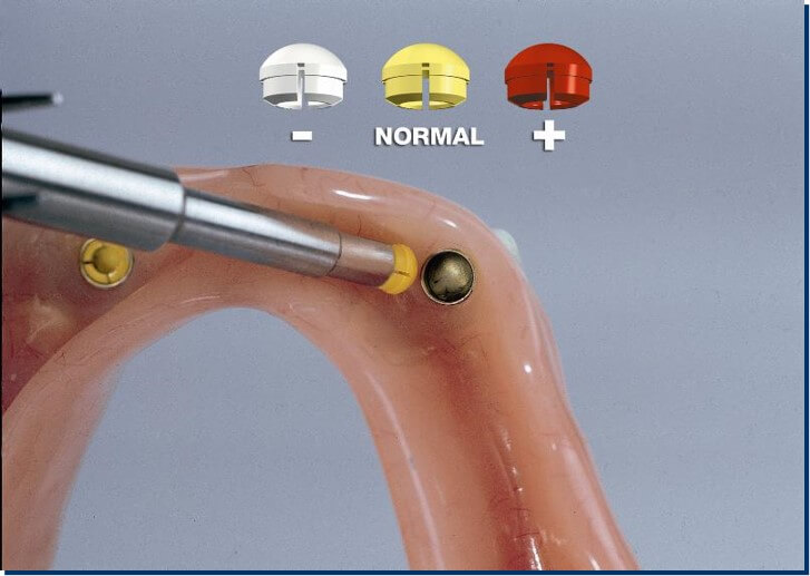 Silicone Cap Set For Ball Attachment Dental Prosthetics – Soft & Standard (Italy)