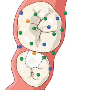 Image illustrates the continuous movement of calcium (green), phosphate (blue) and fluoride ions (orange)between the saliva, tooth and restoration in response to pH changes.