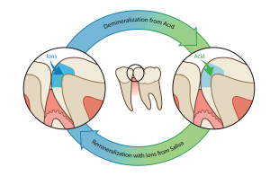 Image shows the natural demineralisation and re-mineralisation cycle in response to changes in pH.