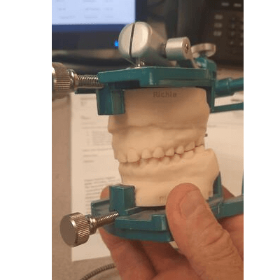 Resin teeth model mounted on Vertex Articulating Systems