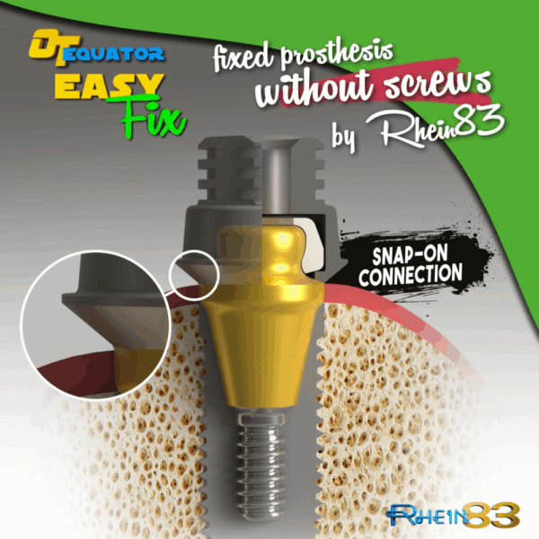 OT Equator Easy Fix